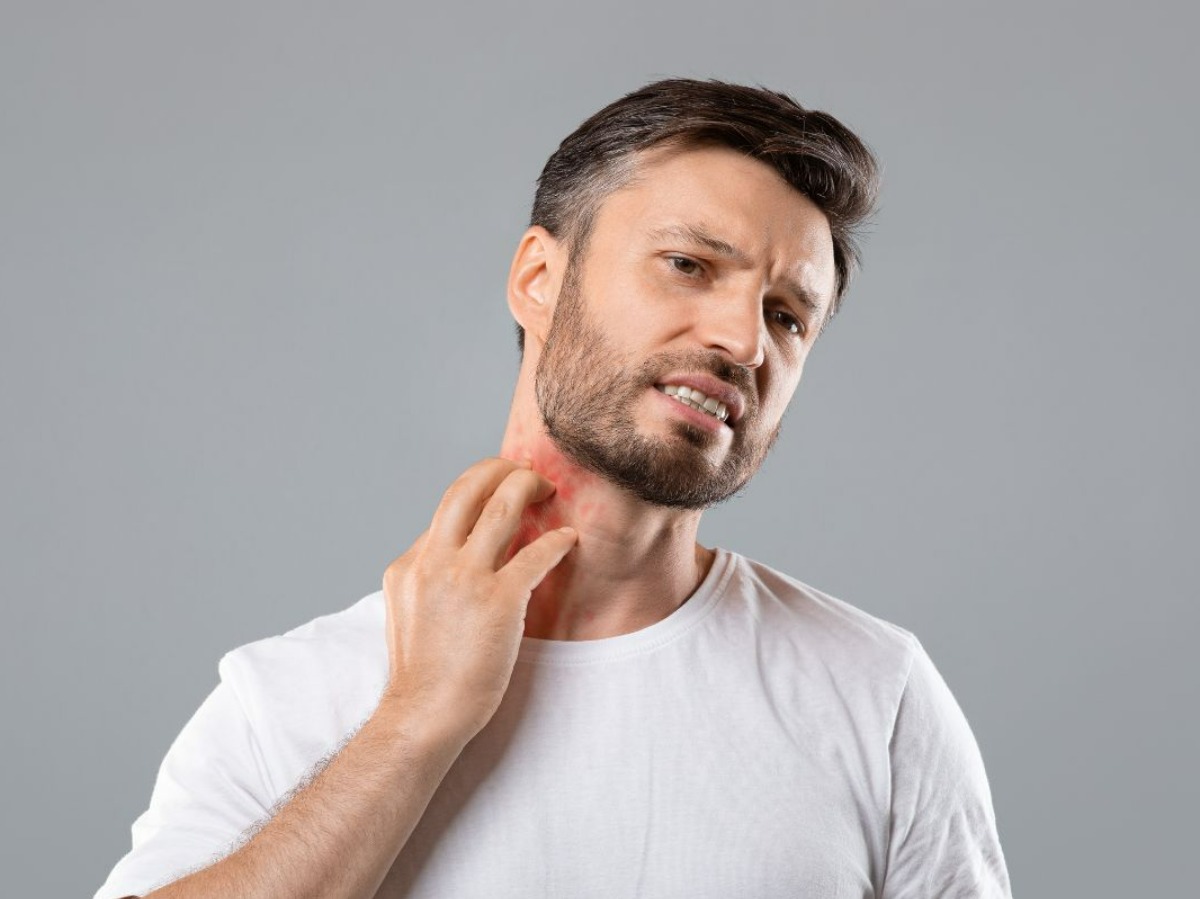 Skin Disease Management